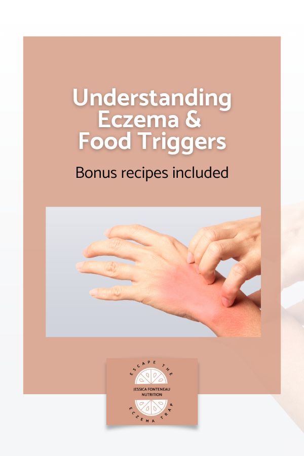 Understanding Eczema & Food Triggers - Escape The Eczema Trap Understanding Eczema & Food Triggers