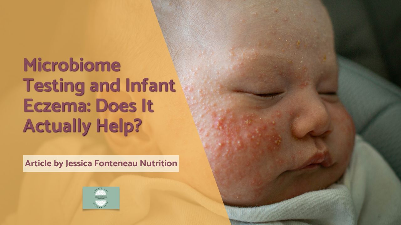 microbiome testing baby eczema