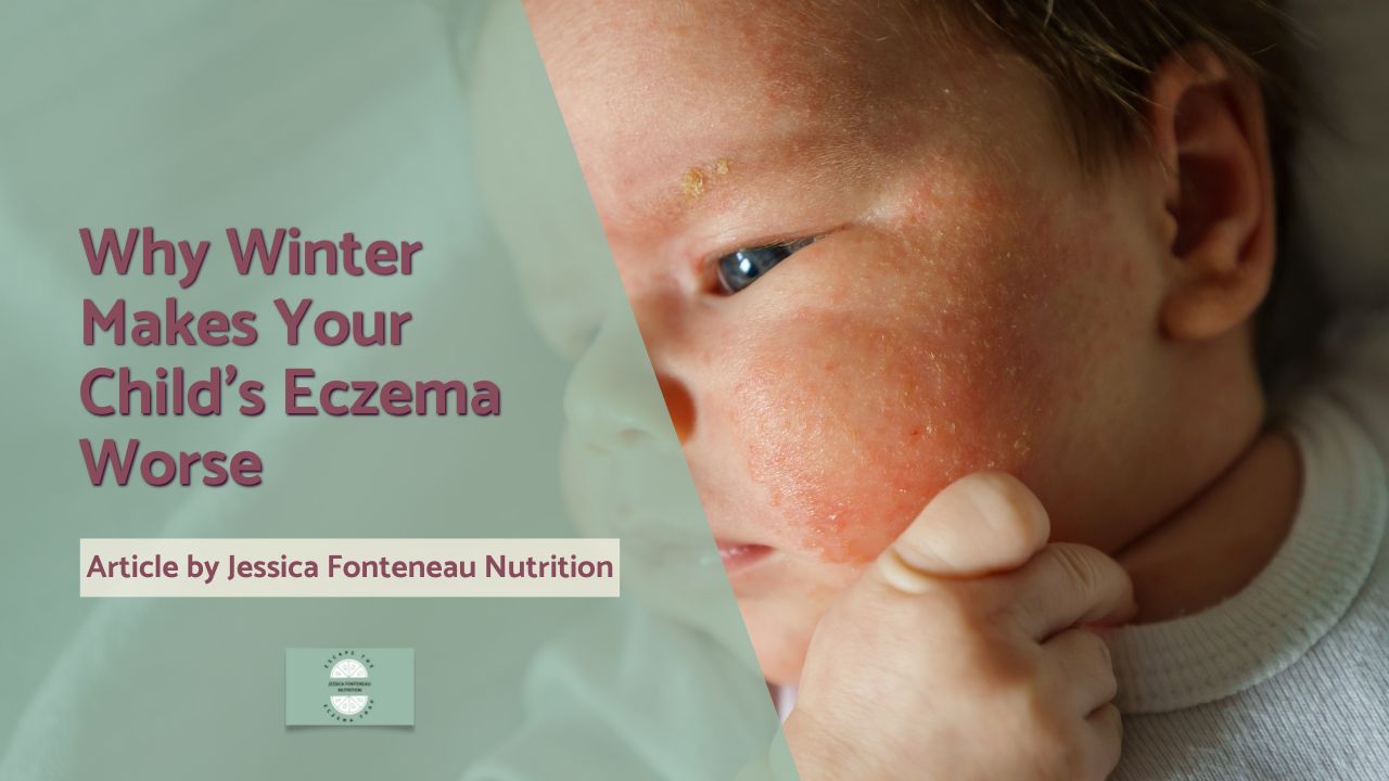 Why Winter makes your child's eczema worse