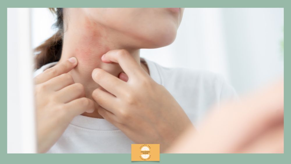 Topical Steroid Withdrawal 2 - Escape The Eczema Trap Topical Steroid Withdrawal: What It Is, Why It Is So Often Dismissed, and how to navigate it with Nutritional Therapy Support - itchy, red neck.
