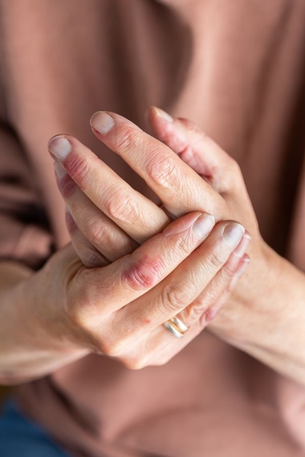 Close-up of an older person's hands clasped together, wearing a gold wedding band.