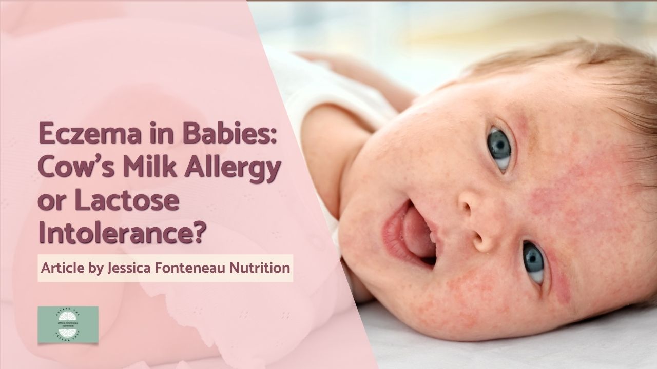 For a shorter and more personal version of this article, you can read the accompanying Escape the Eczema Trap® Substack article here. Your baby has eczema, reflux, loose or mucousy stools and seems uncomfortable after feeding and you suspect that cow’s milk might be triggering it. At some point during a conversation with your GP or a friend, the phrase “lactose intolerance” pops up. You go out, buy the expensive, lactose free formula hoping that it will help and end up second guessing yourself as to whether cow’s milk was the issue, as all of the symptoms remain. I hear versions of this story all the time in my paediatric practice. At the heart of the matter is that cow’s milk allergy and lactose intolerance aren’t interchangeable, despite so much of the information online insinuating that they are. Cow’s milk protein allergy, usually shortened to CMPA or CMA, involves an immune reaction to proteins in cow’s milk. Lactose intolerance happens when there isn’t enough lactase activity to digest lactose, the natural carbohydrate in milk.¹ So if your child has an issue with cow’s milk protein rather than lactose, then just removing the lactose won’t help. The difference can be tricky to spot too. Both can produce digestive symptoms, which is probably why the terms become so easily confused. Beyond that overlap, the physiology, age of presentation, associated symptoms and management are very different. In a baby with eczema, understanding which part of milk is being discussed by your medical practitioner is particularly relevant because skin symptoms belong to the allergic picture, not to lactose malabsorption itself. An eczema diagnosis doesn’t automatically equate with a cow’s milk allergy either. Most babies with eczema don’t need dairy removed from their diet simply because they have eczema, so please don’t simply assume and remove it from your child’s diet. The question becomes more interesting when the skin symptoms are accompanied by persistent digestive problems, feeding difficulties or other features of atopy (hay fever, asthma etc.) Why lactose doesn’t explain the eczema Cow’s milk contains protein and carbohydrates. The main proteins include casein and whey proteins. In CMPA, the immune system reacts to one or more of these proteins and the reaction may be IgE mediated, non IgE mediated or mixed.¹ This is why cow’s milk allergy can involve more than the digestive tract. Skin, gastrointestinal and respiratory symptoms can all form part of an allergic presentation. Lactose is completely different. It is the natural sugar in milk and is broken down in the small intestine by an enzyme called lactase. If lactase activity is insufficient, lactose isn’t completely digested and more of it reaches the lower intestine, where it can contribute to bloating, wind, abdominal discomfort and diarrhoea.² There is no allergic immune reaction to lactose, so lactose malabsorption itself doesn’t explain eczema. That becomes quite an important piece of the puzzle when the skin and digestive symptoms have appeared together. A baby could, of course, have eczema for one reason and digestive symptoms for another, so I wouldn’t assume that the two are definitely linked. But if the suggested explanation for a baby with eczema, persistent diarrhoea and unsettled feeding is simply “lactose intolerance”, it doesn’t account for the skin part of the equation. Age gives us another clue. Primary lactose intolerance generally develops later in childhood, with Lozinsky and colleagues describing onset from around three to four years rather than during early infancy.² Babies are normally very well equipped to digest lactose because it is one of the principal carbohydrates in breast milk. Secondary lactose malabsorption can occur temporarily when the intestinal lining has been damaged, for example following gastroenteritis, but that is a different problem from primary lactose intolerance and it still doesn’t provide an explanation for eczema. When eczema can be part of a cow’s milk allergy picture Cow’s milk allergy doesn’t have a single recognisable presentation. Some babies have mainly digestive symptoms, some have skin symptoms and others have signs across several body systems. Yang and colleagues studied 280 infants with cow’s milk protein allergy who had presented mainly with gastrointestinal problems. Diarrhoea was reported in 61.1%, blood in the stool in 53.2%, vomiting in 25.4% and constipation in 4.6%. Eczema was present in 20.4% of the infants.³ That 20.4% figure is useful for an eczema audience because it keeps things in proportion. Eczema clearly occurred among some infants with CMPA, but most of the infants in this particular CMPA group didn’t have eczema. Cow’s milk allergy and eczema can, therefore, co-exist without CMPA being the trigger for every baby’s eczema.  Most of the infants in Yang’s cohort were also very young, with 72.5% under six months of age.³ That doesn’t mean that nearly three quarters of babies under six months with digestive symptoms have CMPA. These infants had already been identified as having the condition. What it does show is that cow’s milk allergy often becomes apparent early in infancy, which is quite different from the usual timing of primary lactose intolerance. Cavataio and colleagues looked at babies with reflux and found that dermatitis and rhinitis were more common in those whose reflux was linked with cow’s milk protein allergy than in those with reflux alone.⁴ So, when reflux appears alongside eczema or other allergic symptoms, cow’s milk allergy may be worth considering as part of the clinical picture. If I am supporting a baby with eczema, I always want to know the rest of the context. Is there persistent vomiting or reflux? Are stools consistently loose, mucousy or bloody? Is feeding difficult? Is growth being affected? Are there respiratory or other allergic symptoms? Did everything begin around the same time or after a change in feeding? One isolated symptom doesn’t give us the whole picture, but as I so often mention, repeated patterns give us more useful information. Eczema still isn’t a cow’s milk allergy test Parents understandably want to find the magic trigger that is causing the eczema. I understand the temptation. If there’s a single food you could take away and the skin improves, it would feel as if you have finally found something tangible to control. Unfortunately eczema doesn’t work that way and in many cases it is a combination of other underlying factors that need addressing so that the body can cope better, rather than a single trigger.  Skin flares and settles. Babies scratch more at some times than others. Heat, illness, sleep disruption, topical treatment and many other factors can change how the skin looks from one week to the next. If dairy is removed during a particularly bad flare and the skin improves ten days later, it is very easy to conclude that dairy caused the eczema even when that relationship has never been tested. The 2023 ESPGHAN position paper cautions against diagnosing cow’s milk allergy from common infant symptoms and states that overdiagnosis occurs more frequently than underdiagnosis.⁵ Regurgitation, altered stools, crying and feeding difficulties are common during infancy. Even occasional spots of blood in the stool of an otherwise well infant shouldn’t automatically be treated as proof of CMPA.⁵ For eczema families, I think there is an additional danger. Once parents start watching food closely, every flare can become attached to whatever was eaten beforehand. Milk goes first. The eczema doesn’t completely clear, so perhaps soya goes next. Then egg. Then wheat or gluten. Before long, the diet can be far more restricted while the original question, whether any of those foods are actually contributing to the infant’s eczema, has never been properly answered. I would rather explore one plausible relationship properly than remove five foods because they all appeared on somebody’s eczema trigger list. Why a lactose free formula may leave the eczema exactly as it was This is where the wording on formula packaging causes understandable confusion. Lactose free means that the lactose has been removed or substantially reduced. It doesn’t necessarily mean that the cow’s milk proteins have gone with it. If your baby’s immune system is reacting to cow’s milk protein, switching from an ordinary cow’s milk formula to a lactose free cow’s milk formula can therefore leave the relevant proteins in place. The sugar has changed, but the suspected allergen hasn’t. Schrander and colleagues studied 1,158 infants under one year of age and provide one of the few studies in which lactose reduction and cow’s milk protein intolerance both featured in the diagnostic process.⁶ Eighty infants improved after receiving a lactose reduced formula, while 26 were subsequently found to have proven cow’s milk protein intolerance. It would be easy to simply say that the first group all had primary lactose intolerance, but the study doesn’t establish that. Improvement after lactose reduction shows that the dietary change was associated with improvement. It doesn’t actually explore why those infants responded. The study is still useful because it illustrates how similar feeding related digestive symptoms can take clinicians down different diagnostic routes. For the parent of a baby with eczema, I would bring the conversation back to the skin as well as the gut. If diarrhoea improves but eczema doesn’t, that is useful information. If neither changes, that is useful information too. If the eczema and digestive symptoms both improve only when cow’s milk protein is removed, that gives us a different picture again, although it still needs the next step before we can be confident. Removing milk is only half of a diagnostic trial There isn’t one blood test that diagnoses every form of cow’s milk allergy. IgE mediated reactions tend to occur more rapidly and skin prick testing or serum specific IgE may help support the diagnosis when the history suggests this type of reaction.⁷ Non IgE mediated reactions can be slower and may predominantly affect the gastrointestinal tract or skin, so negative IgE testing doesn’t exclude them. For suspected non IgE mediated CMPA, guidelines recommend a defined period without cow’s milk protein followed by planned reintroduction or oral challenge.⁸ A diagnostic elimination commonly lasts around two to four weeks, depending on the type of symptoms. With eczema, I would want the family to know in advance what they are looking for rather than relying on a vague impression that the baby seems “better”. What happens to the extent and severity of their child’s eczema? Is scratching reduced? Are sleep and comfort changing alongside the skin? What happens to the stools, reflux, vomiting and feeding? Taking photographs and keeping simple contemporaneous notes can be far more useful than trying to remember several weeks later. Then comes reintroduction. If cow’s milk protein is removed and the eczema settles, it is tempting never to give it again. But without reintroducing it, where clinically safe, we can’t know whether milk was genuinely responsible for the improvement. Eczema naturally fluctuates and a child could otherwise remain dairy free for months or years on the basis of a coincidence. If symptoms return during an appropriately planned reintroduction, the relationship becomes much more convincing. A previous immediate or severe reaction changes the situation entirely and should be managed with the appropriate medical team rather than challenged at home.⁸ What happens when CMPA is confirmed? For formula fed infants with confirmed CMPA, extensively hydrolysed formula is generally recommended as the first option.¹˒⁸ The cow’s milk proteins have been broken down into smaller peptides to reduce their allergenicity. Amino acid formulas, where the protein is supplied as individual amino acids, are generally reserved for babies with particular clinical needs, including some severe presentations or those who don’t tolerate an extensively hydrolysed formula. If eczema is part of the baby’s presentation, parents understandably focus on whether the new formula clears the skin. I would also want to know what happens to feeding, stools, reflux, growth and general comfort. If several symptoms appeared at the same time, improvement across the wider presentation can give us more useful information than watching one patch of eczema in isolation. Breastfeeding can usually continue when a breastfed baby has confirmed CMPA. The mother may be advised to remove cow’s milk protein from her own diet for a defined period while the baby remains breastfed.¹˒⁸ If she has already stopped eating milk, soya, egg and several other foods because she is frightened of worsening her baby’s eczema, I am far more concerned. A breastfeeding mother needs adequate nutrition herself, and exclusions should have a clinical reason, a defined period of investigation and a plan for what happens next. The eczema food restriction trap This is probably the part of the conversation I see most often in practice and which I try to educate the most against.  A parent notices that their baby’s eczema is bad after a particular feed or meal and removes the food. The eczema improves for a while, then flares again. Another food is removed. The skin settles, then flares. The list gets longer and confidence around feeding gets smaller. Once complementary feeding begins, the effect can become even more obvious. Parents who have watched their child suffer with eczema can become extremely cautious about introducing foods because every new rash or increase in scratching feels threatening. Some children end up eating from a very narrow range of “safe” foods without anyone ever establishing which exclusions were necessary. This is where looking at nutrition purely through the lens of avoiding triggers becomes unhelpful. Skin is living, growing tissue. Babies and young children need sufficient energy and protein, essential fats, vitamins and minerals to support normal growth, skin repair and barrier function. If foods genuinely need to be excluded, the rest of the diet needs to be built around those exclusions properly rather than simply becoming smaller. I am also interested in what happens when foods are put back. Sometimes the useful nutritional work is identifying a genuine food reaction and helping a family manage it safely. Sometimes it is helping parents reintroduce foods that were removed months earlier without a convincing reason. There’s a different conversation to be had in both situations.  Keeping the wider picture in mind CMPA isn’t the only thing that can trigger reflux, vomiting, changes in stools and eczema, which is another reason not to jump straight from symptoms to dietary exclusion.⁹ If symptoms are persistent, your baby isn’t growing as expected, there is repeated blood in the stool or they seem generally unwell, then please book in with your GP or paediatric team rather than continuing to experiment with formula or food exclusions at home. My nutritional therapy role is to look closely at whether a food trigger may be part of your child’s eczema picture, what has already been tried and whether those dietary changes have actually given us useful information. I also want to make sure that, where an exclusion is needed, both your baby’s diet and, where relevant, the breastfeeding mother’s diet remain nutritionally adequate while you work out what is and isn’t contributing to the eczema. But nutritional therapy isn’t only about what we take away. Babies and young children are growing rapidly and need enough energy, protein, essential fats, vitamins and minerals to support that growth, as well as the normal development of their skin, gut and immune system.  I look at whether your child is getting the nutrients they need to thrive, support skin repair and barrier function, and provide the foundations their developing gut needs as it matures. As children grow, their digestive and immune systems become more established and many early food reactions can change too. Supporting good nutrition during that period helps us build a child who is better nourished and more resilient, rather than leaving them on an increasingly restricted diet in the hope that avoiding more foods will solve the eczema. I am also looking at variety, texture, protein intake, essential fats and the gradual introduction or reintroduction of foods where appropriate. Sometimes the work involves identifying a food that genuinely needs to be avoided for a period. Just as often, it involves making sure the foods that remain provide everything your child needs, then widening the diet again as soon as we can, when it is safe to do so. The goal is a child who is eating as broadly as possible, growing well and has the nutritional building blocks their skin and wider body need for repair, development and resilience. Cow’s milk allergy usually isn’t forever Parents can understandably feel quite overwhelmed when a cow’s milk allergy is confirmed, particularly if they are already dealing with difficult eczema. It can sound as though milk has now disappeared from the child’s life indefinitely. For most children, that isn’t actually the case. Høst and colleagues followed children with cow’s milk protein allergy or intolerance over their childhood. Around 56% had recovered by one year, 77% by two years, 87% by three years and 92% by five years. By 15 years of age, 97% were tolerant.¹⁰ Children with IgE mediated allergy can follow a different course and no population statistic tells us exactly when an individual child will tolerate milk, but the data is broadly reassuring. Reintroduction, therefore, is a really important part of most children’s plans.  For suitable children this may eventually involve a tailored milk ladder, beginning with more extensively heated forms of milk protein and gradually progressing towards less processed milk. The BSACI guideline includes graded reintroduction as part of cow’s milk allergy management, with the approach determined by the child’s clinical history and type of reaction.¹¹ Eczema families often find this stage emotionally difficult. After months of watching the skin and worrying about food, putting milk back can feel completely counterintuitive. Clear guidance around when reintroduction is appropriate, what form of milk to begin with, how much to offer and what symptoms to watch for can make an enormous difference. And the skin still needs to be interpreted carefully. A small eczema fluctuation during reintroduction isn’t necessarily the same as a reproducible allergic reaction. Equally, a consistent return of the same skin and gastrointestinal pattern is also relevant. The history or patterns observed over time give us much more information than a single flare, even if that flare is a bad one. What I see in my paediatric eczema practice By the time families come to see me, they have often already done a great deal of work. They have changed formula, removed foods, read ingredient labels, kept diaries, photographed nappies and spent far too much time searching online at two o’clock in the morning. They don’t need any more information, they need someone who can see the wood for the trees.  I go back to when the eczema first started and what was happening with feeding at the time. Was the baby exclusively breastfed and, if so, were symptoms already present? Did anything change when formula was introduced? Were there digestive symptoms before the eczema or did everything begin together? What formulas have actually been used? Were they ordinary cow’s milk formula, lactose free, extensively hydrolysed or amino acid based? How long was each one tried and what happened while the baby was taking it? With breastfeeding families, I look at exactly what Mum has removed and what replaced it. “I stopped dairy” can represent very different diets. One mother may have replaced milk and yoghurt with fortified alternatives and continued eating a broad diet. Another may have taken out dairy, soya, egg and wheat and be struggling to eat enough while caring for a baby who is constantly waking and itching. I also look beyond the question of milk. If food is being identified as the cause of every eczema flare, I want to review whether the history actually supports that. If a genuine reaction is plausible, we can check it in a structured way. If the diet has become narrow because of fear rather than reproducible reactions, rebuilding variety can become a vital part of supporting the child’s skin and wider health. In my practice, eczema alongside digestive symptoms is something I see all the time. Clinical observation can’t establish causation, but the consistency of the pairing of the two is something that I am very aware of. What I don’t see is one universal eczema diet or one food that explains every child or every reaction. The work is identifying which areas are relevant to that particular baby or child without creating restrictions that offer no benefit and could cause harm.  Where nutritional therapy can help I work alongside GPs, dermatologists, paediatricians and allergy teams, looking at the detailed nutritional and feeding history that can be difficult to cover in a short medical appointment. That may include assessing what has already been removed, whether previous dietary trials actually tested the suspected trigger, whether nutritional intake remains adequate and how complementary feeding is progressing. If cow’s milk genuinely needs to be removed, I can help make sure the diet around that exclusion stays nutritionally sound. If your child has reached the point where several foods are being avoided without a clear reason, we can work through what can safely be reconsidered. If you are breastfeeding and your own diet has become increasingly restricted in an attempt to calm your baby’s eczema, your nutritional needs need looking after too. And sometimes the most useful outcome is finding that food isn’t the main issue. That is also valuable information. It allows a family to stop chasing dietary triggers and direct their time and energy elsewhere. If your baby or child has eczema and you are no longer sure whether cow’s milk, lactose or any other food is genuinely involved, you can book a discovery call with me to talk through whether nutritional therapy would be a useful next step. BOOK A DISCOVERY CALL For a shorter and more personal version of this article, you can read the accompanying Escape the Eczema Trap® Substack article here. So, is it cow’s milk allergy or lactose intolerance? If your baby has eczema, the first thing to remember is that lactose intolerance doesn’t explain the skin. It can cause digestive symptoms, but it is not an allergic condition. Cow’s milk protein allergy can include eczema as part of the presentation, particularly when skin symptoms sit alongside persistent gastrointestinal or other allergic features, but eczema alone still isn’t enough to diagnose it. A lactose free formula may therefore be completely the wrong dietary experiment if cow’s milk protein is what you are trying to investigate. Equally, removing dairy simply because a baby has eczema can create a restriction that was never needed. The useful work sits in between those two extremes. Look at the whole pattern, be clear about what part of milk is actually being tested, remove it properly if a diagnostic elimination is clinically appropriate, and reintroduce it as soon as it is safe to do so. That gives you far more information about your child’s eczema than continuing to remove foods one after another and hoping eventually the skin will tell you why it is flaring. References Kansu A, Yüce A, Dalgıç B, et al. Consensus statement on diagnosis, treatment and follow up of cow’s milk protein allergy among infants and children in Turkey. Turk J Pediatr. 2016. doi:10.24953/TURKJPED.2016.01.001. Lozinsky AC, Meyer R, Anagnostou K, et al. Cow’s milk protein allergy from diagnosis to management: a very different journey for general practitioners and parents. Children. 2015. doi:10.3390/children2030317. Yang Q, Zheng B, Zhou S, Dai D. Clinical features of cow’s milk protein allergy in infants presenting mainly with gastrointestinal symptoms: an analysis of 280 cases. Zhongguo Dang Dai Er Ke Za Zhi. 2019. Cavataio F, Iacono G, Montalto G, et al. Clinical and pH metric characteristics of gastro oesophageal reflux secondary to cows’ milk protein allergy. Arch Dis Child. 1996. doi:10.1136/adc.75.1.51. Vandenplas Y, Broekaert I, Domellöf M, et al. An ESPGHAN position paper on the diagnosis, management and prevention of cow’s milk allergy. J Pediatr Gastroenterol Nutr. 2023. doi:10.1097/MPG.0000000000003897. Schrander JJP, van den Bogart JPH, Forget PP, et al. Cow’s milk protein intolerance in infants under 1 year of age: a prospective epidemiological study. Eur J Pediatr. 1993. doi:10.1007/BF01955238. Greef E, Hauser B, Devreker T, et al. Diagnosis and management of cow’s milk protein allergy in infants. World J Pediatr. 2012. doi:10.1007/s12519-012-0332-x. Koletzko S, Niggemann B, Arató A, et al. Diagnostic approach and management of cow’s milk protein allergy in infants and children: ESPGHAN GI Committee practical guidelines. J Pediatr Gastroenterol Nutr. 2012. doi:10.1097/MPG.0b013e31825c9482. Al Beltagi M, Saeed NK, Bediwy AS, et al. Cow milk protein allergy mimics in infancy. World J Clin Pediatr. 2025. doi:10.5409/wjcp.v14.i3.103788. Høst A, Halken S, Jacobsen HP, et al. Clinical course of cow’s milk protein allergy/intolerance and atopic diseases in childhood. Pediatr Allergy Immunol. 2002. doi:10.1034/j.1399-3038.13.s.15.7.x. Luyt D, Ball H, Makwana N, et al. BSACI guideline for the diagnosis and management of cow’s milk allergy. Clin Exp Allergy. 2014. doi:10.1111/cea.12302.