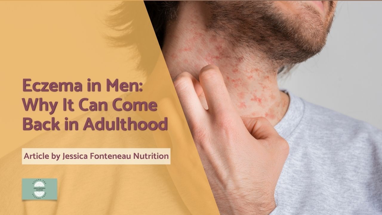 Eczema in Men: Why It Can Come Back in Adulthood